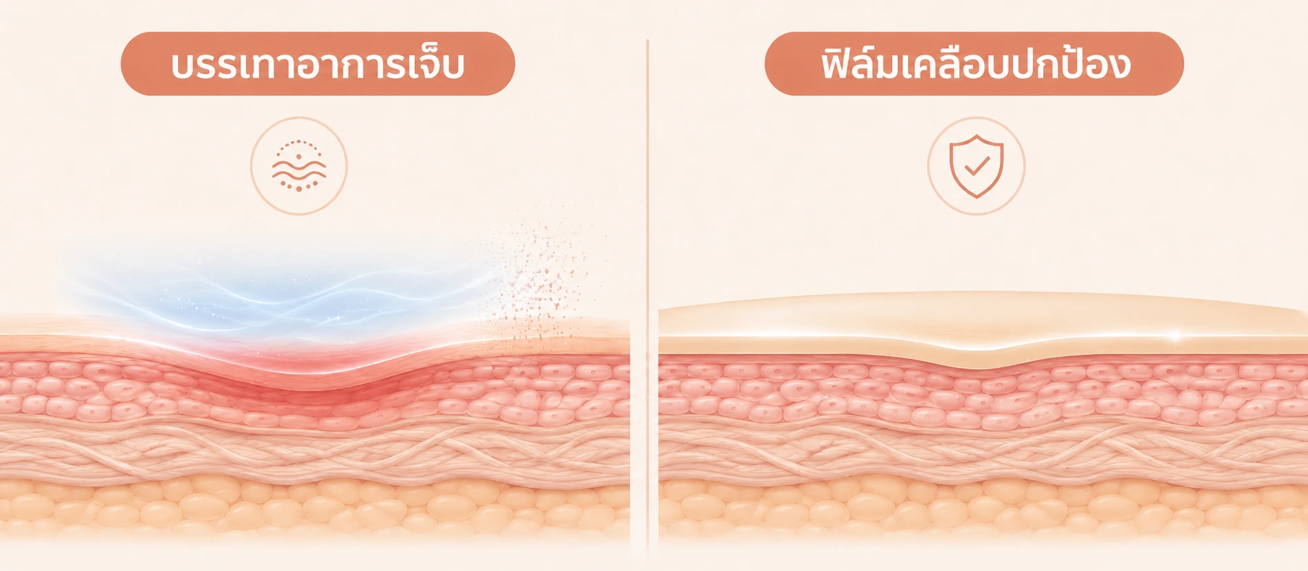 ภาพเปรียบเทียบระหว่างการลดปวดกับการเคลือบแผล